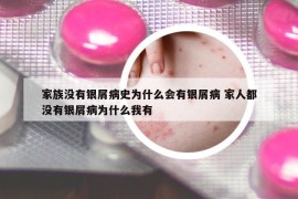 家族沒有銀屑病史為什么會有銀屑病 家人都沒有銀屑病為什么我有