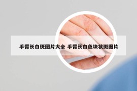 手臂長白斑圖片大全 手臂長白色塊狀斑圖片