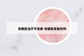 杏鮑菇治療牛皮癬 杏鮑菇皮能吃嗎