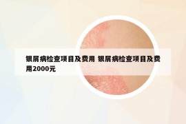 銀屑病檢查項目及費用 銀屑病檢查項目及費用2000元