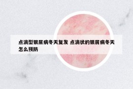 點(diǎn)滴型銀屑病冬天復(fù)發(fā) 點(diǎn)滴狀的銀屑病冬天怎么預(yù)防