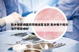 新鄉(xiāng)銀屑病醫(yī)院薦楊淑蓮當(dāng)?shù)?新鄉(xiāng)哪個(gè)地方治療銀屑病好