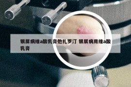銀屑病維a酸乳膏他扎羅汀 銀屑病用維a酸乳膏