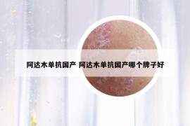 阿達(dá)木單抗國(guó)產(chǎn) 阿達(dá)木單抗國(guó)產(chǎn)哪個(gè)牌子好