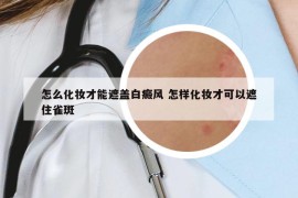 怎么化妝才能遮蓋白癜風(fēng) 怎樣化妝才可以遮住雀斑