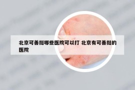 北京可善挺哪些醫(yī)院可以打 北京有可善挺的醫(yī)院