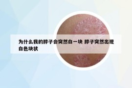 為什么我的脖子會(huì)突然白一塊 脖子突然出現(xiàn)白色塊狀