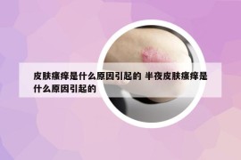 皮膚瘙癢是什么原因引起的 半夜皮膚瘙癢是什么原因引起的