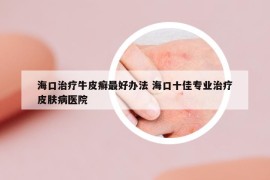 海口治療牛皮癬最好辦法 ?？谑褜I(yè)治療皮膚病醫(yī)院