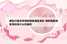 病友們是怎樣預(yù)防銀屑病復(fù)發(fā)的 預(yù)防銀屑病復(fù)發(fā)的有什么藥最好