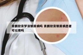 青鵬軟膏夢涂銀屑病嗎 青鵬軟膏銀屑病患者可以用嗎