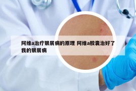 阿維a治療銀屑病的原理 阿維a膠囊治好了我的銀屑病