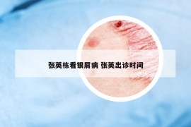 張英棟看銀屑病 張英出診時(shí)間