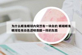 為什么眼角眼球內突然有一塊白的 眼睛眼角眼球處有白色透明像膜一樣的東西