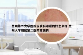 蘭州第二大學醫(yī)院皮膚科誰看的好怎么樣 蘭州大學附屬第二醫(yī)院皮膚科
