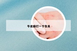 牛皮癬打一個生肖