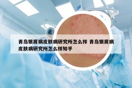 青島銀屑病皮膚病研究所怎么樣 青島銀屑病皮膚病研究所怎么樣知乎