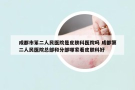 成都市笫二人民醫(yī)院是皮膚科醫(yī)院嗎 成都第二人民醫(yī)院總部和分部哪家看皮膚科好