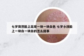 七歲突然臉上出現(xiàn)一塊一塊白色 七歲小孩臉上一塊白一塊白的怎么回事