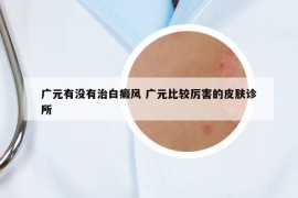 廣元有沒(méi)有治白癜風(fēng) 廣元比較厲害的皮膚診所
