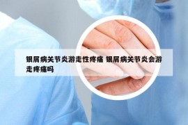 銀屑病關(guān)節(jié)炎游走性疼痛 銀屑病關(guān)節(jié)炎會游走疼痛嗎