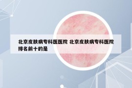 北京皮膚病?？漆t(yī)醫(yī)院 北京皮膚病?？漆t(yī)院排名前十的是