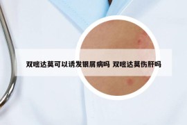 雙嘧達莫可以誘發(fā)銀屑病嗎 雙嘧達莫傷肝嗎