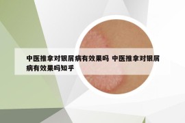 中醫(yī)推拿對銀屑病有效果嗎 中醫(yī)推拿對銀屑病有效果嗎知乎