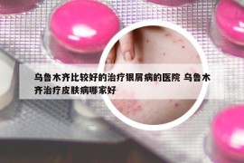 烏魯木齊比較好的治療銀屑病的醫(yī)院 烏魯木齊治療皮膚病哪家好
