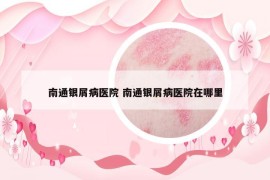 南通銀屑病醫(yī)院 南通銀屑病醫(yī)院在哪里