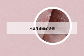 小兒牛皮癬的誘因