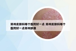 鄭州皮膚科哪個醫(yī)院好一點 鄭州皮膚科哪個醫(yī)院好一點鄭州膚康