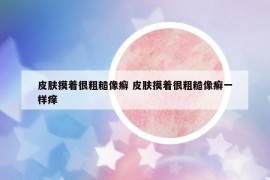皮膚摸著很粗糙像癬 皮膚摸著很粗糙像癬一樣癢