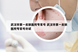 武漢市第一皮膚醫(yī)院專(zhuān)家號(hào) 武漢市第一皮膚醫(yī)院專(zhuān)家號(hào)許斌
