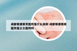 成都銀康銀宵醫(yī)院是什么級別 成都銀康銀屑醫(yī)院是公立醫(yī)院嗎