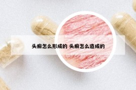 頭癬怎么形成的 頭癬怎么造成的