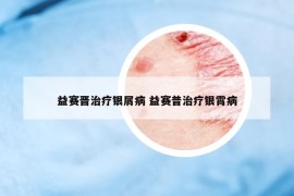 益賽晉治療銀屑病 益賽普治療銀霄病