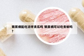銀屑病能吃涼拌青瓜嗎 銀屑病可以吃青椒嗎?