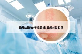 異維A酸治療銀屑病 異維a酸脫屑