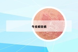 牛皮癬腎病