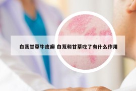 白芨甘草牛皮癬 白芨和甘草吃了有什么作用