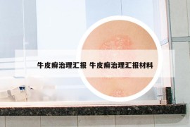 牛皮癬治理匯報 牛皮癬治理匯報材料