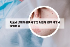 兒童點(diǎn)狀銀屑病快好了怎么還癢 孩子得了點(diǎn)狀銀屑病
