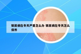 銀屑病在冬天嚴(yán)重怎么辦 銀屑病在冬天怎么保養(yǎng)