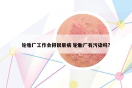 輪胎廠工作會得銀屑病 輪胎廠有污染嗎?