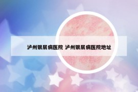 瀘州銀屑病醫(yī)院 瀘州銀屑病醫(yī)院地址