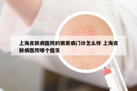 上海皮膚病醫(yī)院的銀屑病門診怎么樣 上海皮膚病醫(yī)院哪個醫(yī)生