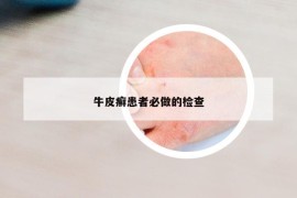 牛皮癬患者必做的檢查