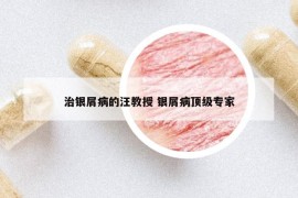 治銀屑病的汪教授 銀屑病頂級專家