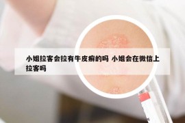 小姐拉客會(huì)拉有牛皮癬的嗎 小姐會(huì)在微信上拉客嗎